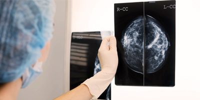 Mamografia Normal, Descubra Como é o Resultado de Mamografia